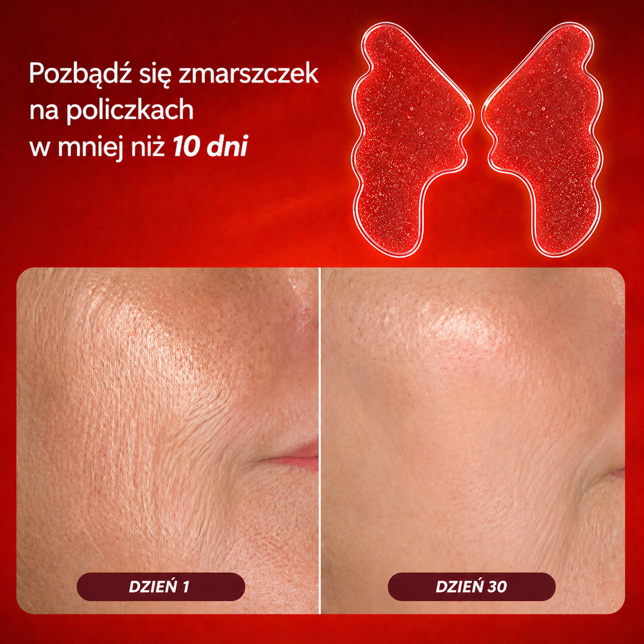 Plastry przeciwzmarszczkowe na policzki