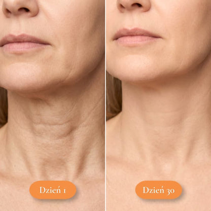 Plaster przeciwzmarszczkowy na szyję